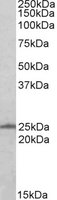 EB06419-T 1