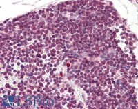 EB06419-T 2