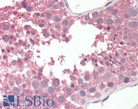 EB09067 1