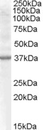 EB07855 1