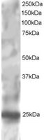 EB05421 1