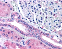 EB06853 1