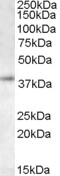 EB05834 1