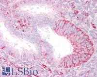 EB05871 1
