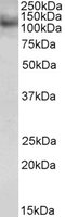 EB05587 1