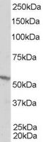 EB06524 1