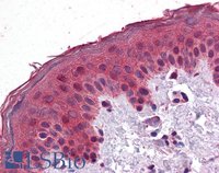 EB08906 2