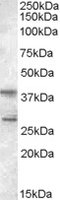 EB05356 2