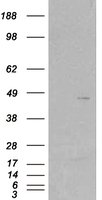 EB05356 1