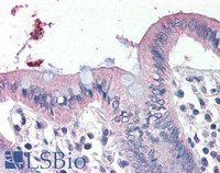EB08972 1