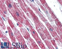 EB06868 2