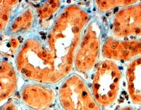 EB07352 1