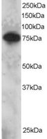 EB05734 1