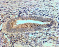 EB09115 2