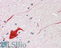 EB05114 2
