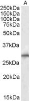 EB05292-T 1