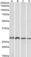 EB05292-T 2