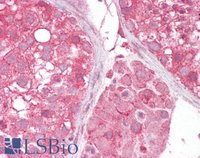 EB05131 2