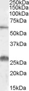 EB09191 1
