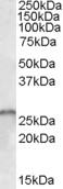 EB07704 1
