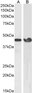 Goat Anti-Smooth muscle alpha-actin Antibody