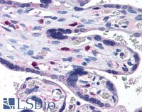 EB05904 3