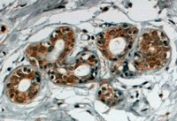 EB06217 2