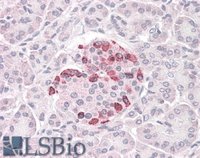 EB05347 1