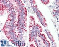 EB10825 1