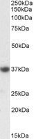 EB12566 1