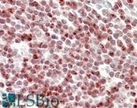 EB09486 1
