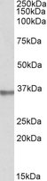 EB09965 1