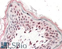 EB11094 1