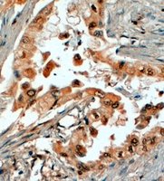 EB06638 1