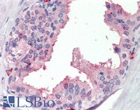 EB09209 1