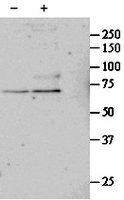 EB09543 1