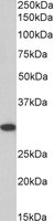 EB05885 2