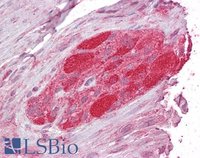 EB05327 2