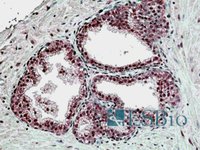 EB06309 1