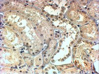 EB05313 1