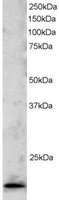 EB05614 1