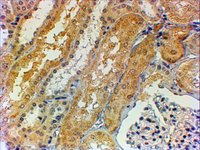 EB11098 1