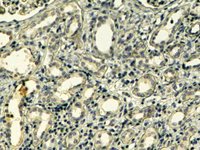 EB05119 1