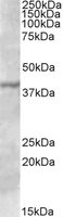 EB09559 1