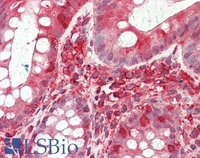 EB10931 2
