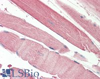 EB11889 2