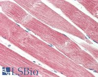 EB11888 1