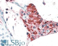 EB10560 1