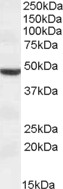 EB08298 1