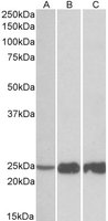 EB12036 1